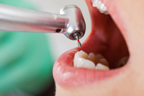 Best Dentist for Dental Trauma  in Falmouth, KY